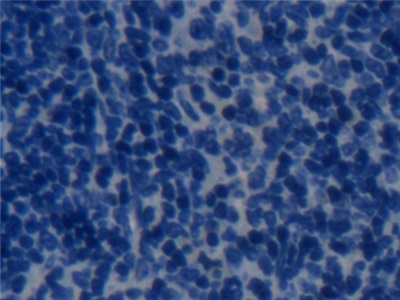 Polyclonal Antibody to Transmembrane Protein 1 (TMEM1)