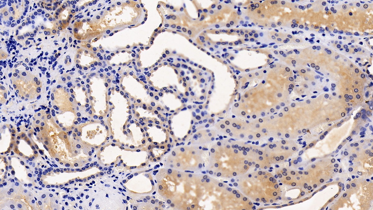 Polyclonal Antibody to Transmembrane Protease, Serine 2 (TMPRSS2)