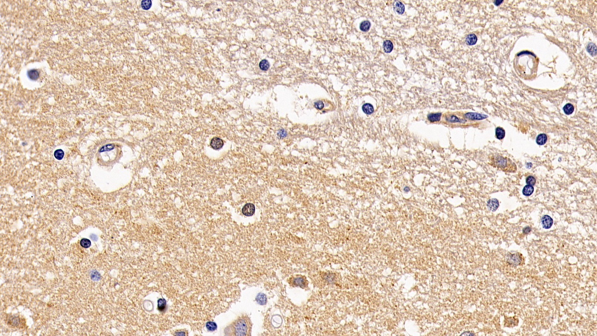 Polyclonal Antibody to Transmembrane Protease, Serine 2 (TMPRSS2)