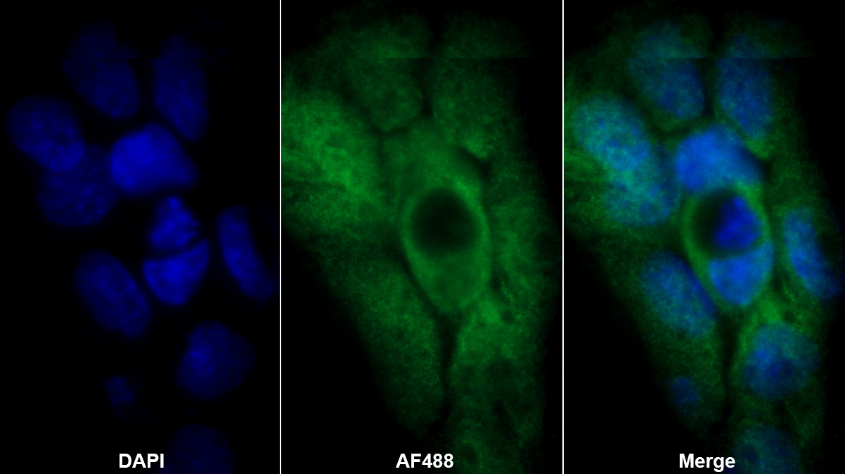 Polyclonal Antibody to Tumor Necrosis Factor Alpha Induced Protein 3 (TNFaIP3)