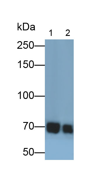 Polyclonal Antibody to Tyrosine Kinase, Non Receptor 2 (TNK2)