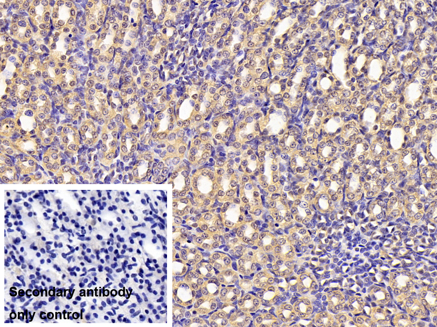 Polyclonal Antibody to Tyrosine Kinase, Non Receptor 2 (TNK2)