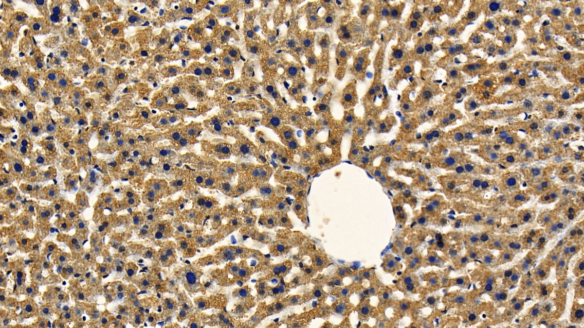 Polyclonal Antibody to Toll Interacting Protein (TOLLIP)