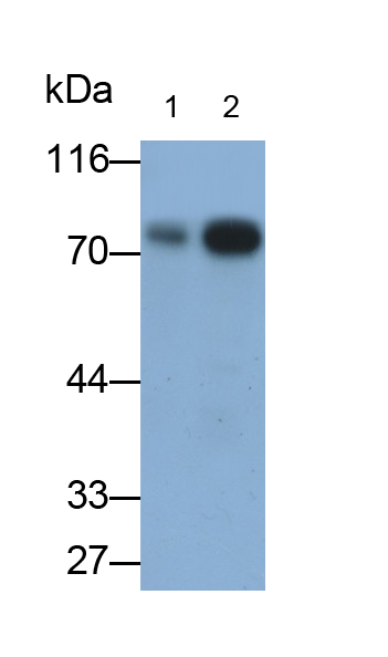 Polyclonal Antibody to Tumor Protein P63 (TP63)