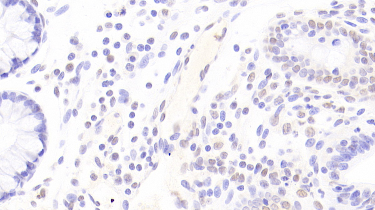 Polyclonal Antibody to Three Prime Repair Exonuclease 1 (TREX1)