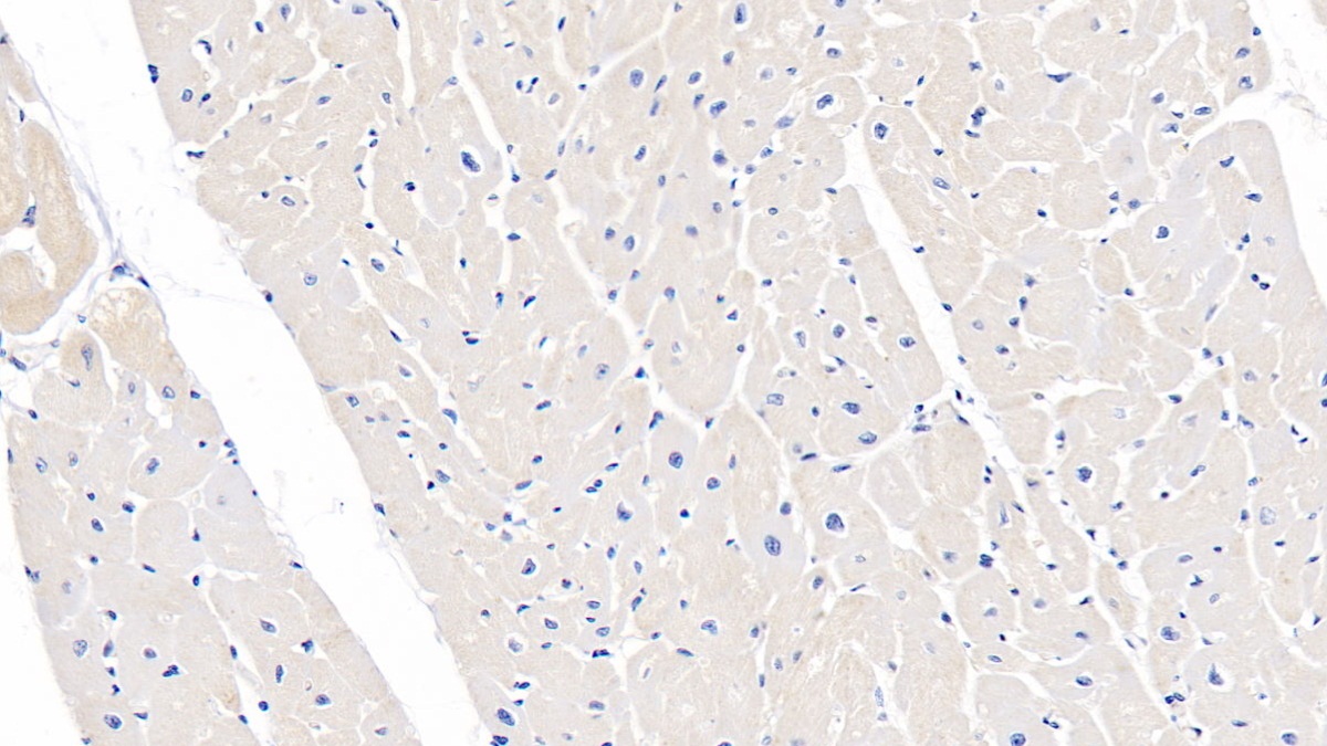 Polyclonal Antibody to Tuberous Sclerosis Protein 1 (TSC1)