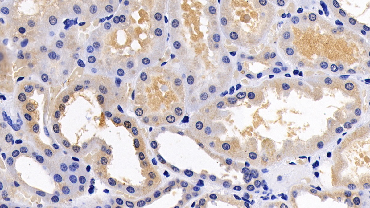 Polyclonal Antibody to Tuberous Sclerosis Protein 1 (TSC1)