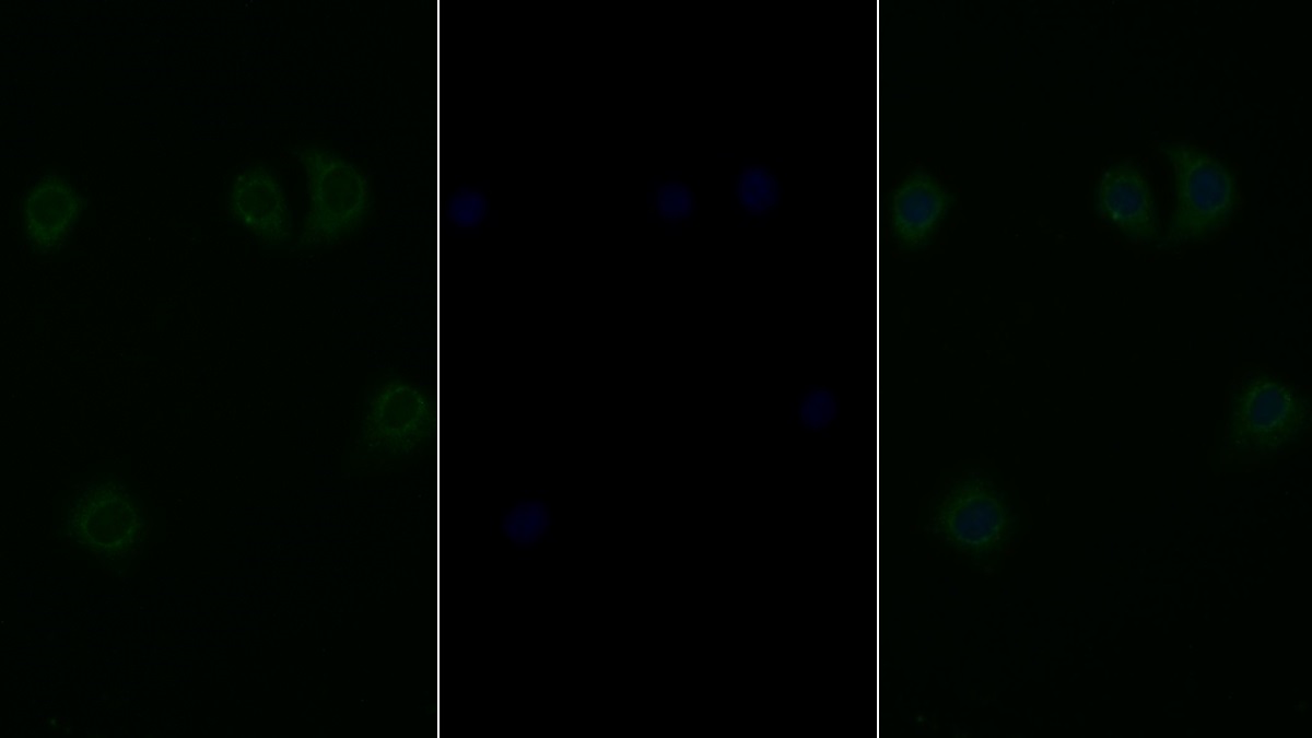 Polyclonal Antibody to Tuberous Sclerosis Protein 1 (TSC1)