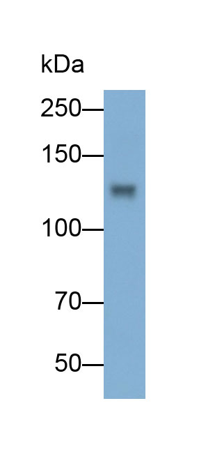 Polyclonal Antibody to Tuberous Sclerosis Protein 1 (TSC1)