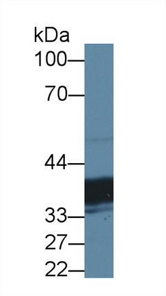 Polyclonal Antibody to Thiosulfate Sulfurtransferase (TST)