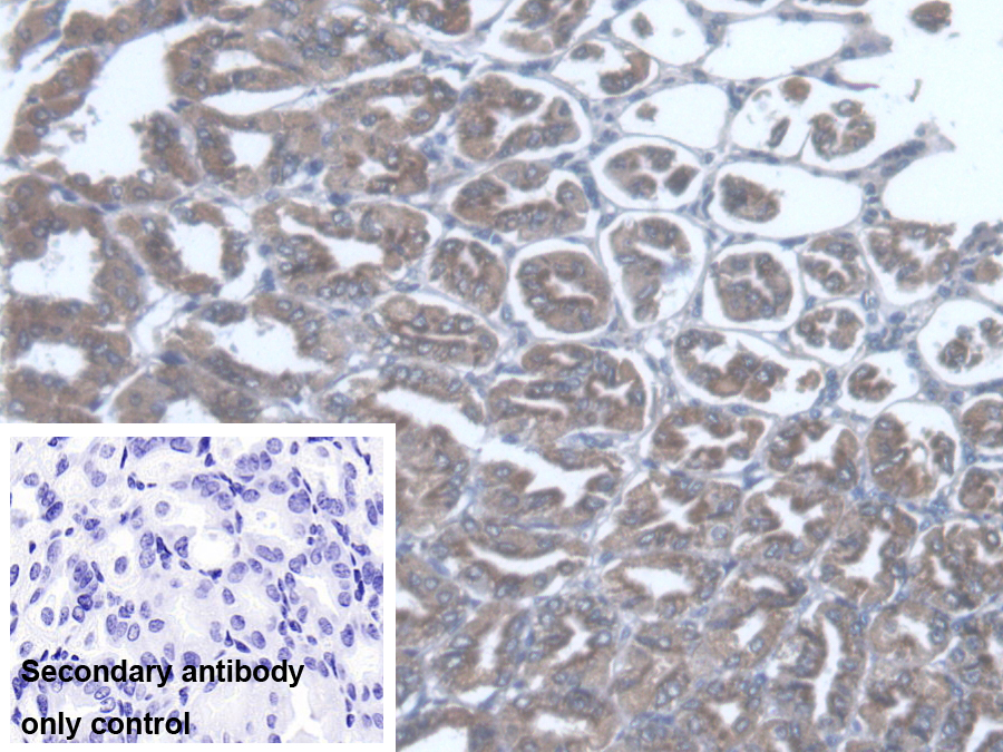 Polyclonal Antibody to Thiosulfate Sulfurtransferase (TST)