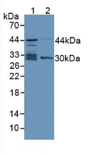 Polyclonal Antibody to Thiopurine Methyltransferase (TPMT)