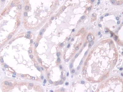 Polyclonal Antibody to Thiopurine Methyltransferase (TPMT)