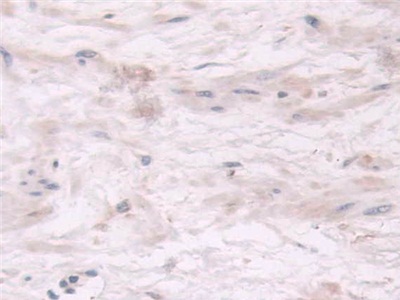 Polyclonal Antibody to Thiopurine Methyltransferase (TPMT)