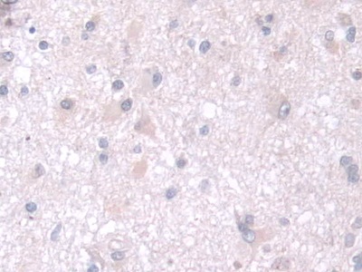 Polyclonal Antibody to Thiopurine Methyltransferase (TPMT)