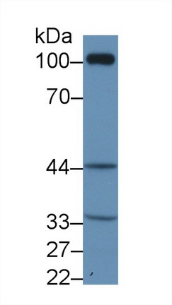 Polyclonal Antibody to Thromboxane Receptor (TP)