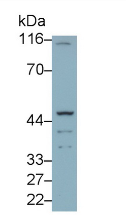 Polyclonal Antibody to Thromboxane Receptor (TP)