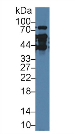 Polyclonal Antibody to Thymopoietin (TMPO)