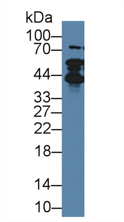 Polyclonal Antibody to Thymopoietin (TMPO)