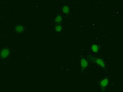 Polyclonal Antibody to Thymopoietin (TMPO)