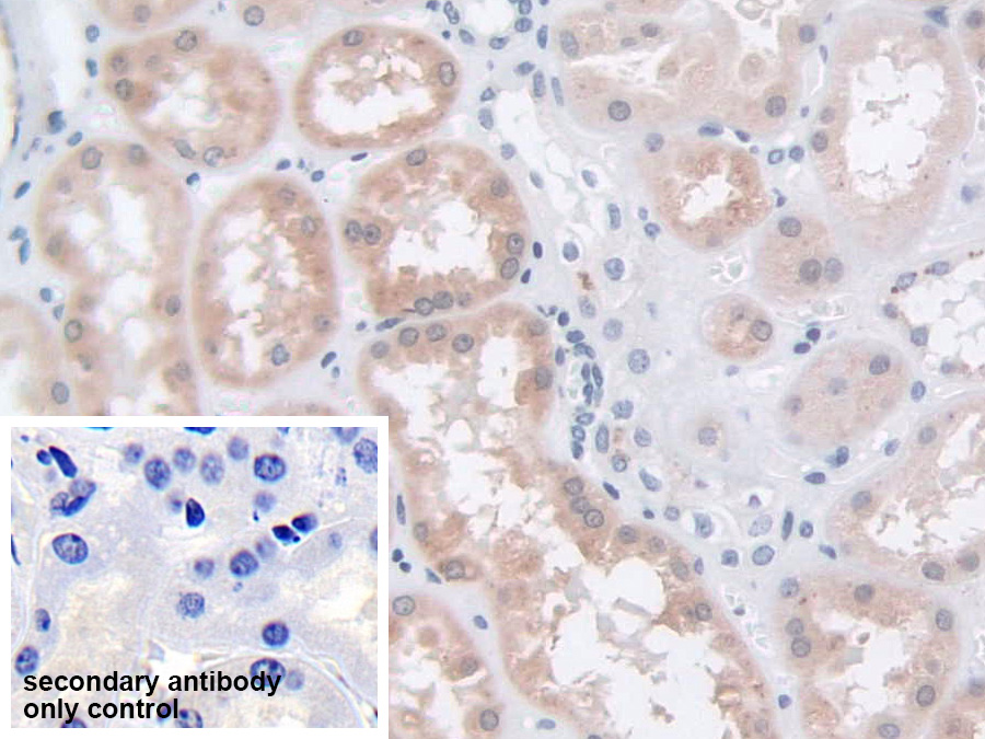 Polyclonal Antibody to Tripeptidyl Peptidase I (TPP1)