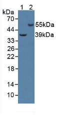 Polyclonal Antibody to Adenylyl Cyclase Associated Protein 2 (CAP2)