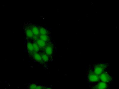 Polyclonal Antibody to Adenylyl Cyclase Associated Protein 2 (CAP2)