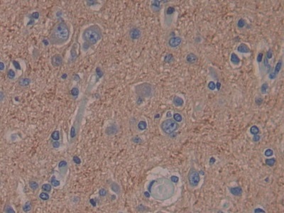 Polyclonal Antibody to Adenylyl Cyclase Associated Protein 2 (CAP2)