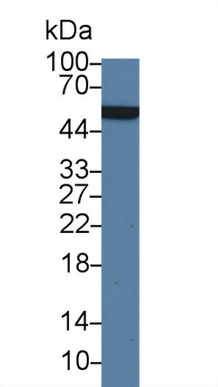 Polyclonal Antibody to Adenylyl Cyclase Associated Protein 2 (CAP2)