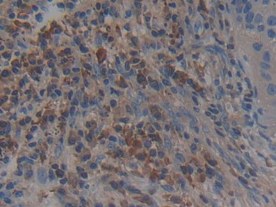 Polyclonal Antibody to Adenylyl Cyclase Associated Protein 2 (CAP2)