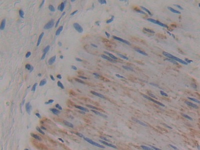 Polyclonal Antibody to Adenylyl Cyclase Associated Protein 2 (CAP2)