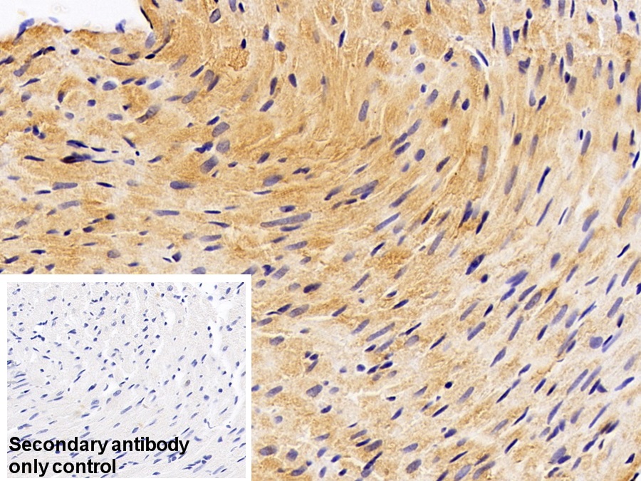 Polyclonal Antibody to Adenylyl Cyclase Associated Protein 2 (CAP2)