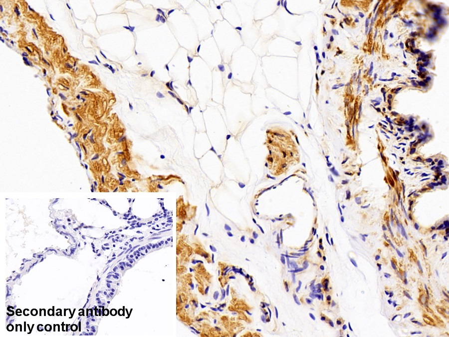 Polyclonal Antibody to Adenylyl Cyclase Associated Protein 2 (CAP2)