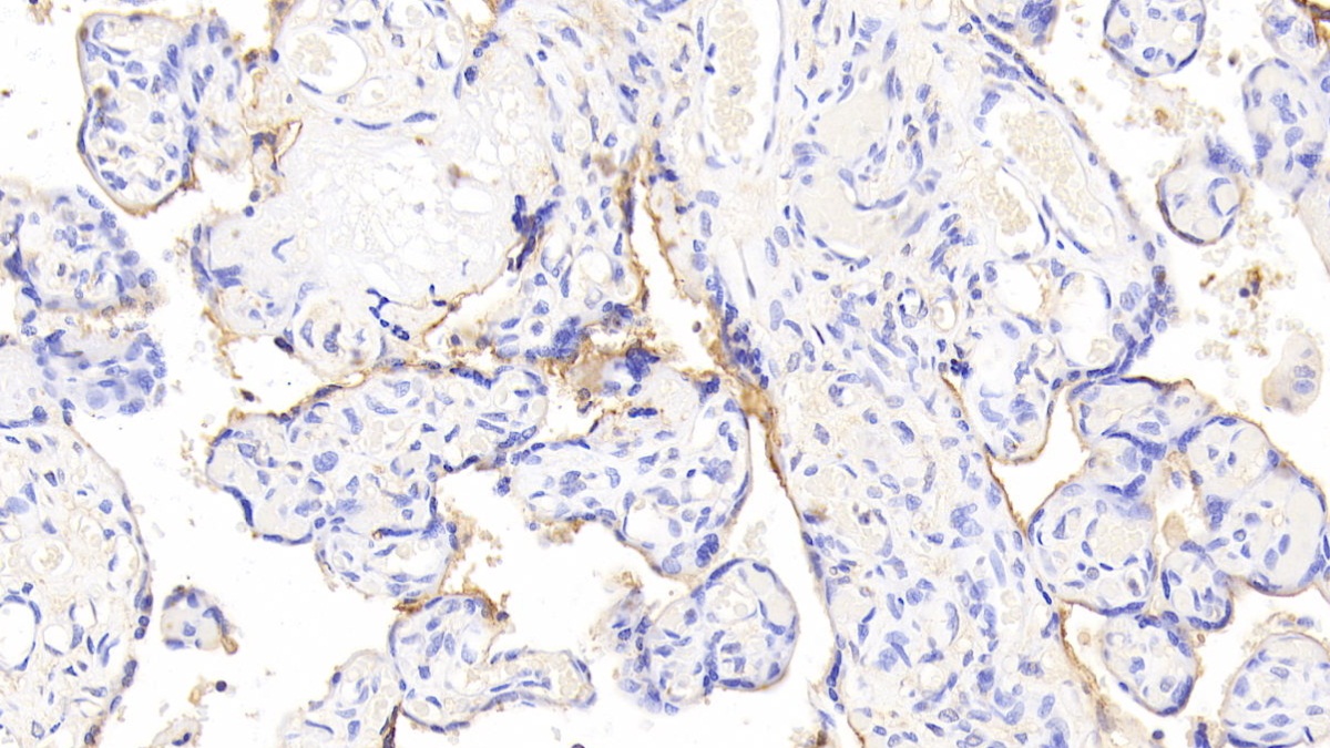 Polyclonal Antibody to Sterol Carrier Protein 2 (SCP2)