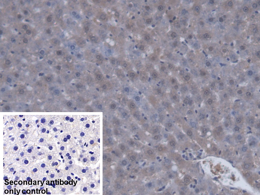 Polyclonal Antibody to Sterol Carrier Protein 2 (SCP2)