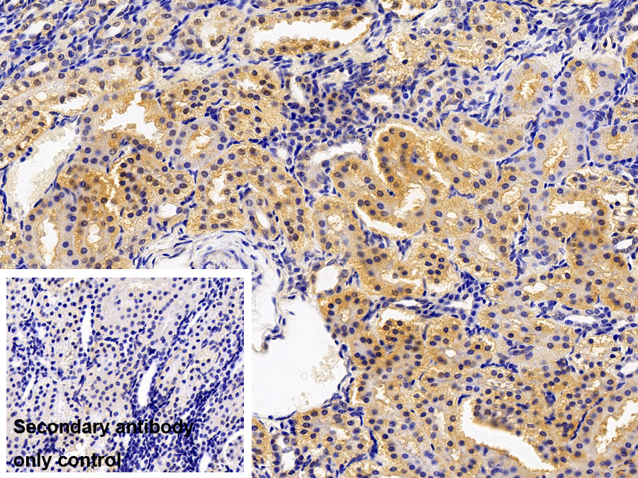 Polyclonal Antibody to Secernin 1 (SCRN1)