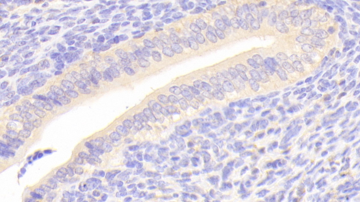 Polyclonal Antibody to Secernin 1 (SCRN1)