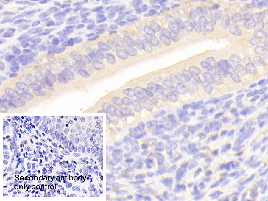 Polyclonal Antibody to Secernin 1 (SCRN1)