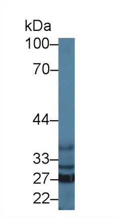 Polyclonal Antibody to Sideroflexin 1 (SFXN1)