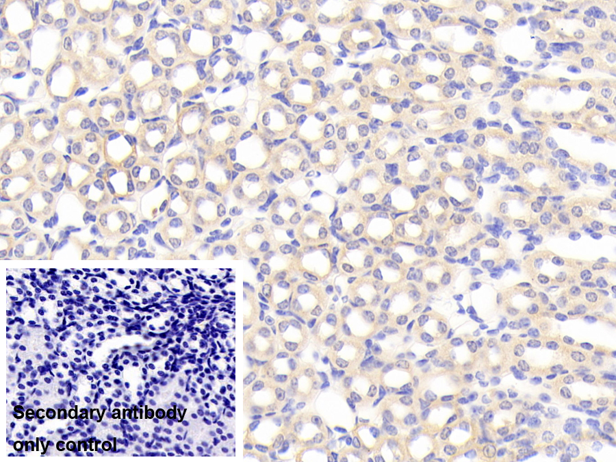 Polyclonal Antibody to Sideroflexin 1 (SFXN1)