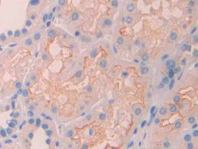 Polyclonal Antibody to Renalase (RNLS)