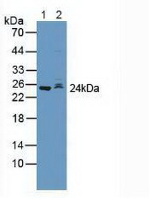 Polyclonal Antibody to S-Phase Kinase Associated Protein 2 (SKP2)