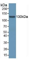 Polyclonal Antibody to Aminoadipate Semialdehyde Synthase (AASS)