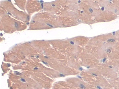 Polyclonal Antibody to Aminoadipate Semialdehyde Synthase (AASS)