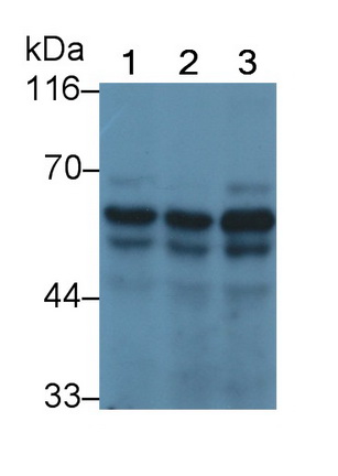 Polyclonal Antibody to Smoothelin (SMTN)