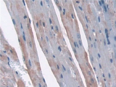 Polyclonal Antibody to Sorting Nexin Associated Golgi Protein 1 (SNAG1)