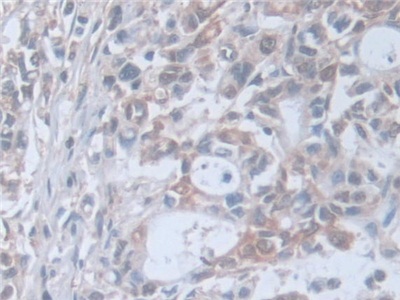 Polyclonal Antibody to Synaptosomal Associated Protein 23kDa (SNAP23)