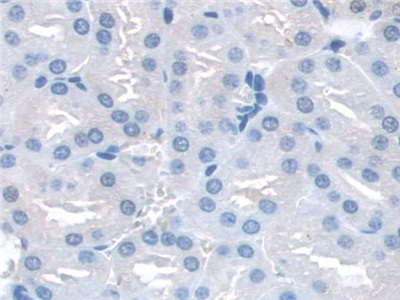 Polyclonal Antibody to Synaptosomal Associated Protein 23kDa (SNAP23)