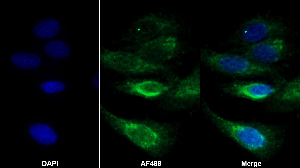 Polyclonal Antibody to Synaptosomal Associated Protein 23kDa (SNAP23)