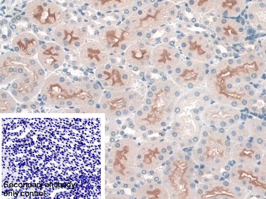 Polyclonal Antibody to Syntrophin Beta 1 (SNTb1)